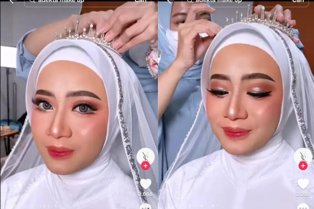 Riasan Pengantin untuk Penderita Vitiligo
