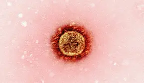 Ilustrasi Cacar Air (Foto: Unsplash/National Institute of Allergy and Infectious Diseases)