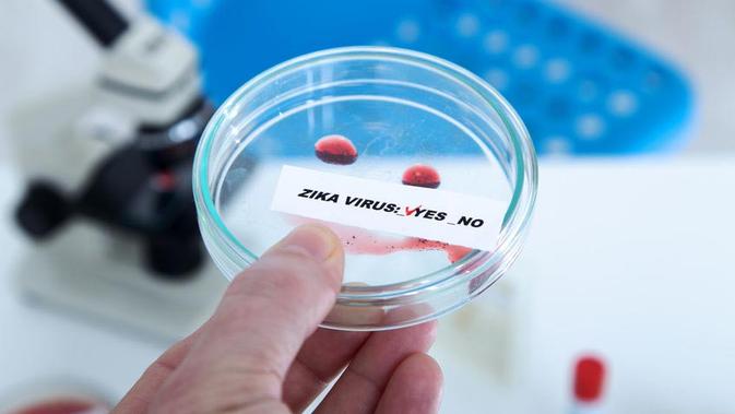 Ciri-Ciri Virus Zika