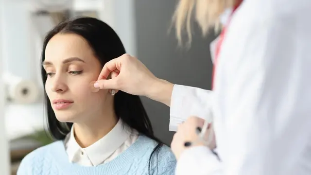 Gunakan Acne Patch saat Berjerawat