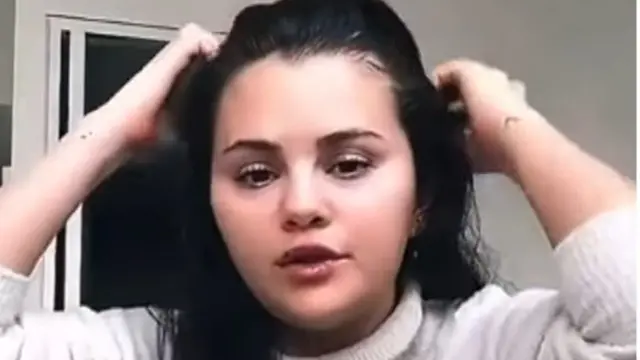 Selena Gomez buka-bukaan soal efek pengobatan lupus yang membuat berat badannya naik.