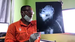 Aktivis COP menunjukkan hasil autopsi Orangutan yang mati ditembus 130 Peluru di Bontang, Kalimantan Timur (7/2). Setelah mendapat perawatan dari tim media di Taman Nasional Kutai, Orangutan tersebut akhirnya tewas. (AFP/Center For Orangutan Protection)