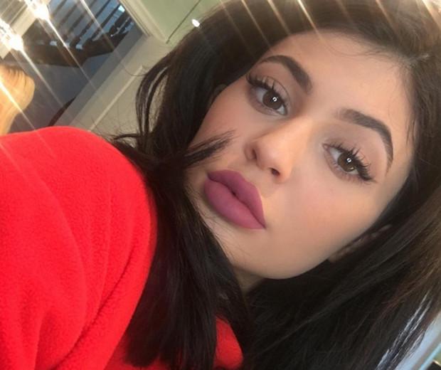 Suntik Sedikit Trend Bibir Tebal Cinderella Jadi Milikmu Beauty Fimela Com