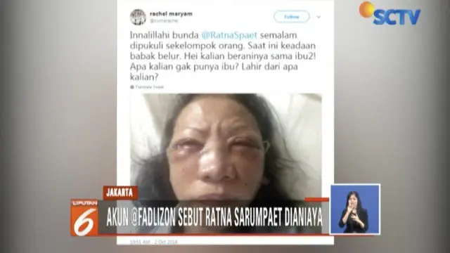 Kronologi Dugaan Ratna Sarumpaet Dianiaya Berawal dari Kicauan Akun Fadli Zon