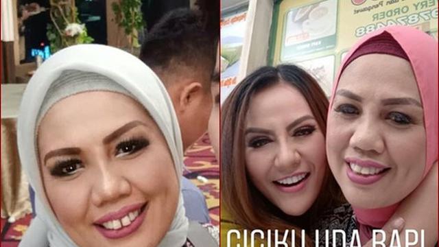 Beda Gaya Ely Sugigi Sebelum Vs Sesudah Potong Gigi (sumber: instagram/ellysugigi_real_)