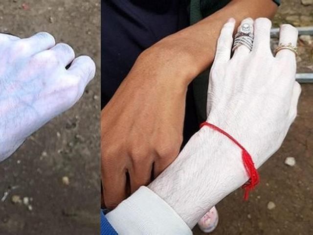 Viral Krim Pemutih Kulit Hasilnya Bikin Geleng Kepala Hot Liputan6 Com