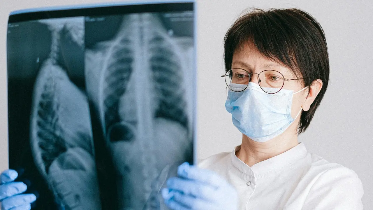 X Ray rusuk