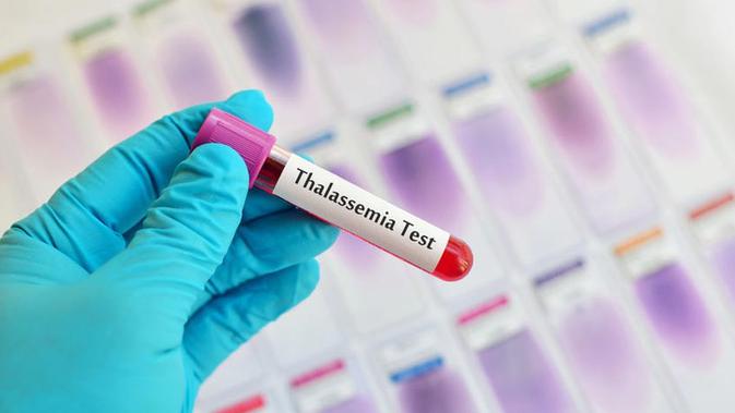 Mengenal Lebih Dekat Thalassemia