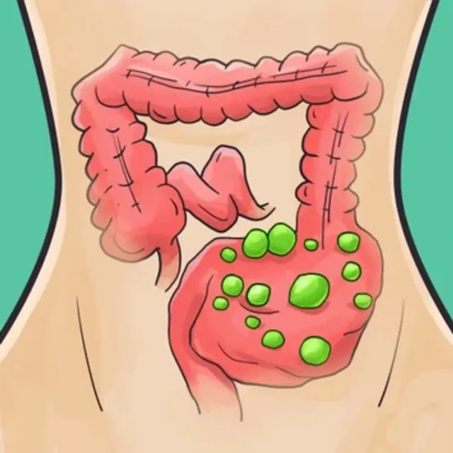 Antara Usus dan Otak, Temuan Terbaru dalam Ilmu Kesehatan Ini Tak Terduga