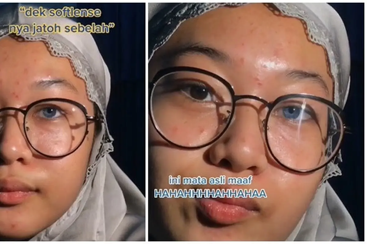 Sering Dikira Pakai Lensa Kontak, Warna Iris Mata Wanita Ini Curi Perhatian
