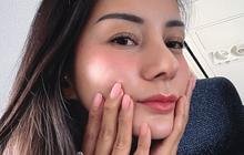 Potret Terbaru Kirana Larasati yang Kini Punya Hidung Mancung, Akui Jalani Prosedur Operasi Plastik di Thailand Agar Lebih Cantik