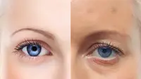 7 Cara Kembalikan Kulit Cantik Setelah Berhenti Merokok