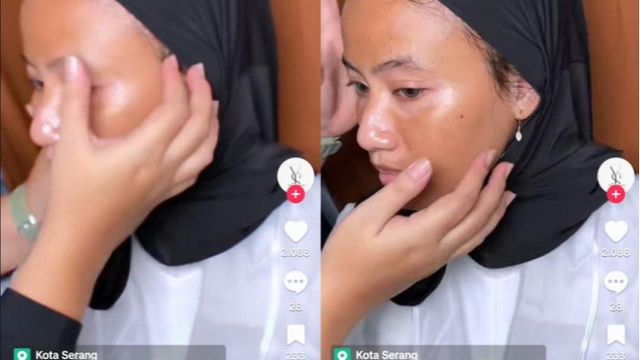 Skin Preparation: Riasan Pengantin untuk Penderita Vitiligo