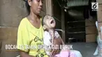 Seorang bocah 15 tahun di Sulawesi Barat hanya memiliki berat badan 6,7 kilogram.
