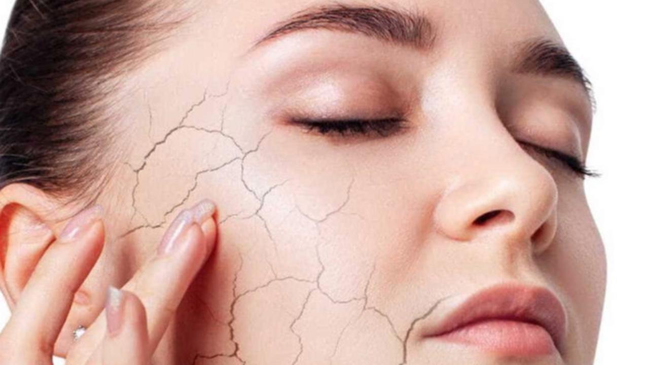 Jangan Biarkan Kulit Kering Mengganggu! 6 Tips Ampuh Atasi Kulit Kering Saat Musim Dingin