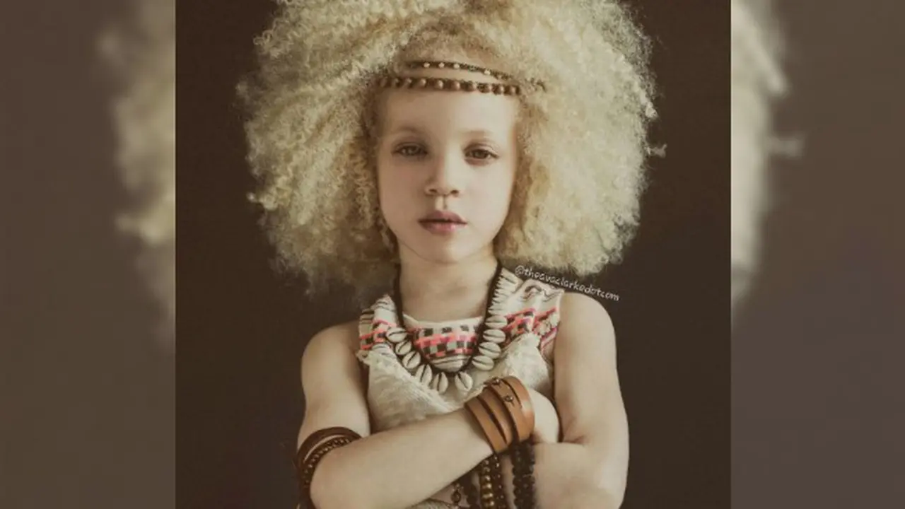 Ava Clarke, Gadis Albino Ini Bikin Publik Terpukau