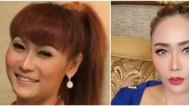 Potret Inul Daratista sebelum dan sesudah tanam benang (Sumber: Kapanlagi.com & Instagram/@inul.d)