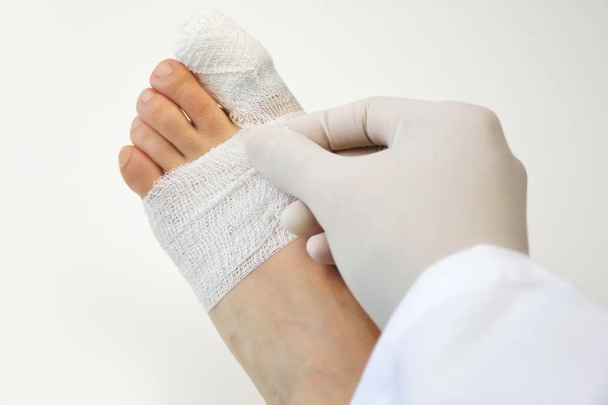 Ilustrasi kaki (iStockphoto)