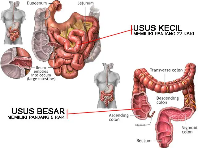 Terganggu sistem pencernaan | via: radangususbesar.com