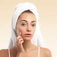 Hindari hal berikut agar jerawat tidak bertambah parah (Credit: Freepik/wayhomestudio)