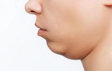 Bikin Wajah Lebih Tirus! Ini 6 Cara Alami Hilangkan Double Chin Tanpa Ribet