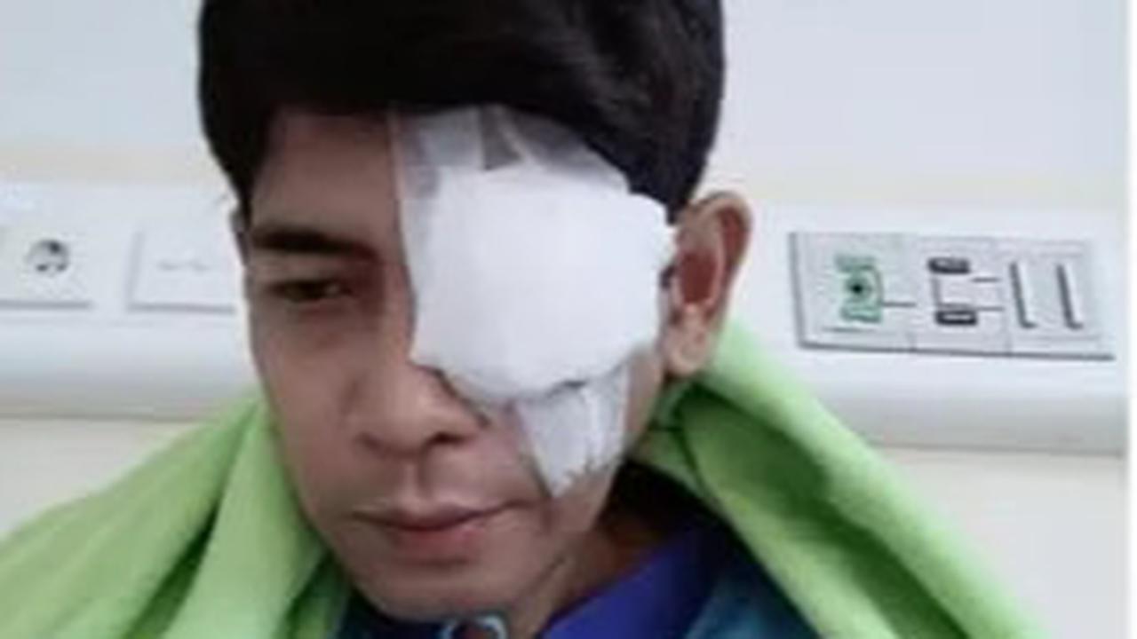 Lama Tak Terdengar Kabarnya, Begini Kondisi Veri AFI Usai Jalani Operasi Mata Kiri
