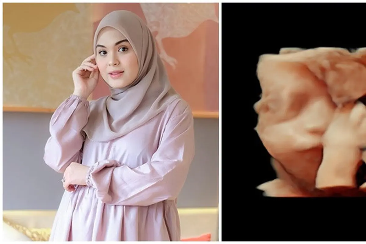 6 Momen Vebby Palwinta dan Suami Ungkap Jenis Kelamin Buah Hatinya