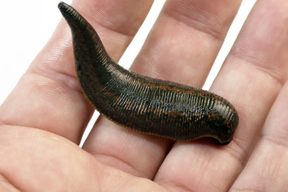 terapi lintah
