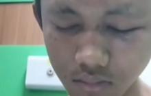 Kasus Pengeroyokan Mahasiswa Undip Naik Penyidikan, Enam Saksi Diperiksa Polisi