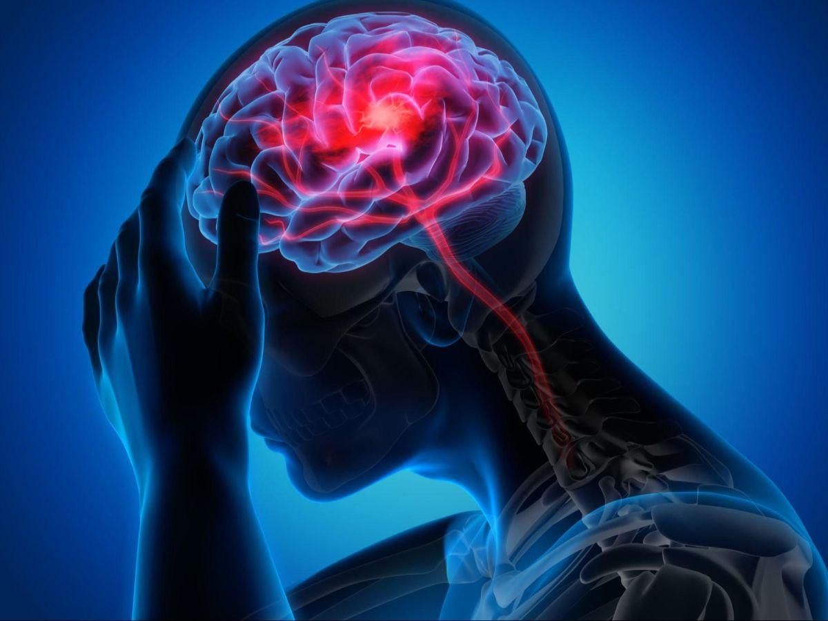 Faktor Risiko Penyakit Stroke