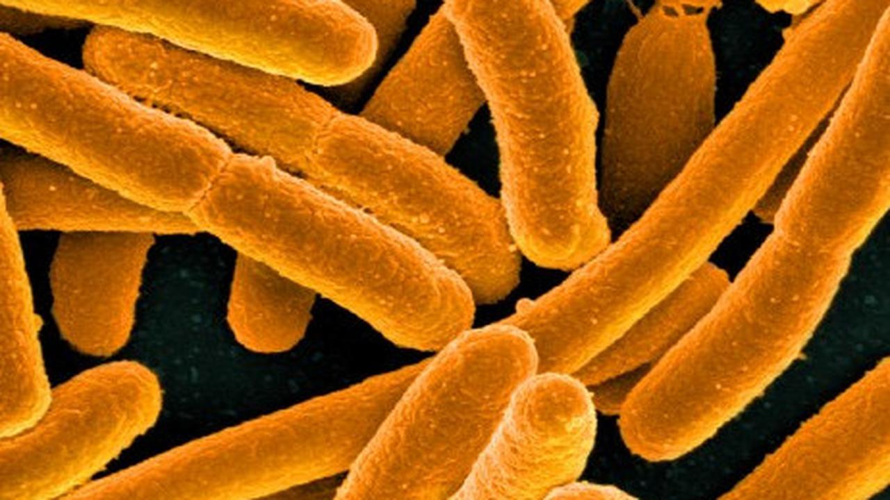 bakteri e.coli