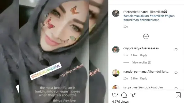 model dan artis Rhere Valentina meninggal dunia
