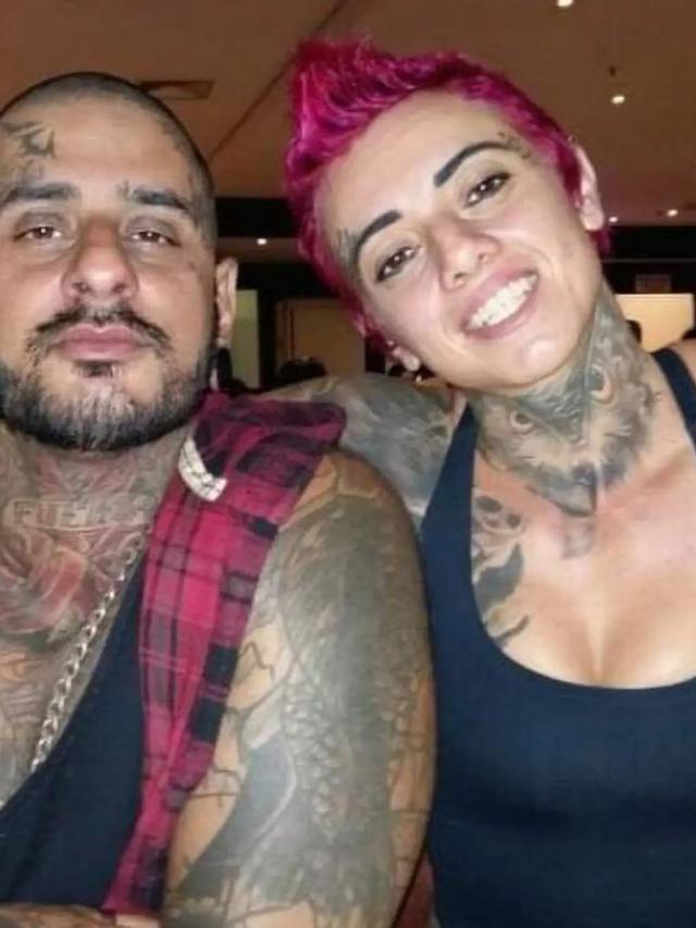 Pria Ini Jalani Operasi untuk Mengubah Tangan Jadi Cakar