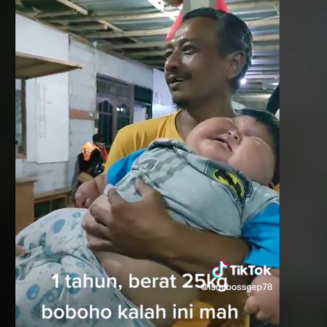 Viral bayi 1 tahun miliki berat badan 25 kg