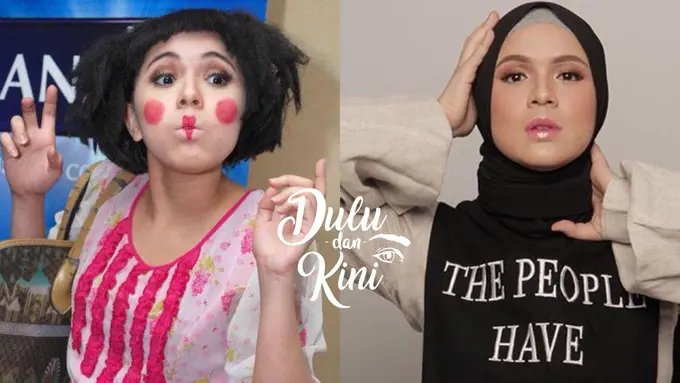 Dulu dan Kini: Dulu Semrawut, Transformasi Nycta Gina Sekarang Super Cantik!