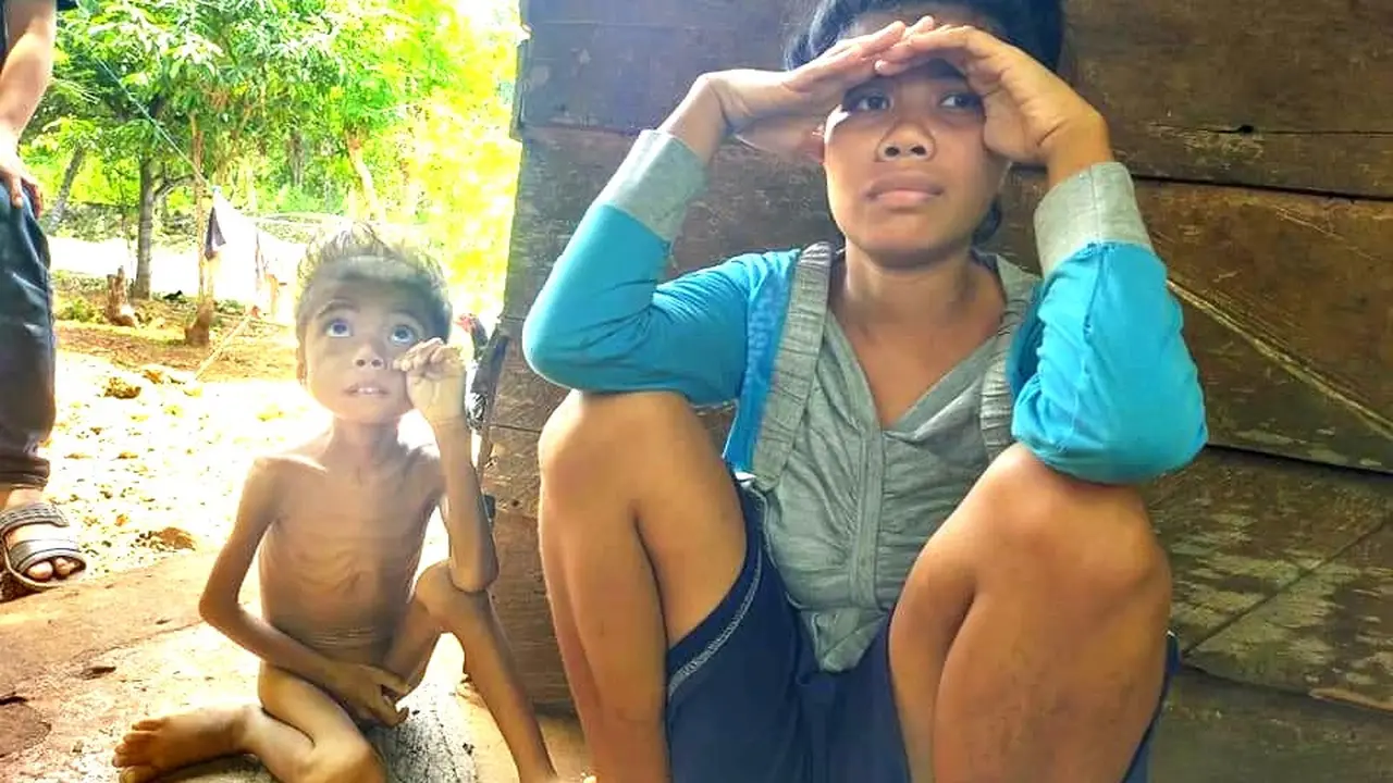 Bocah penderita gizi buruk di Buton Tengah, La Rungge (6) dan ibunya Wa Lani (23).(Liputan6.com/Ahmad Akbar Fua)
