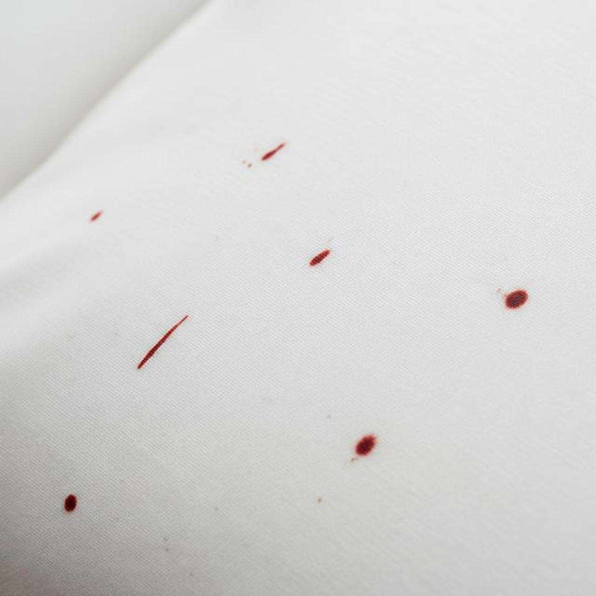 Cara Mengetahui Ada Kutu Kasur di Springbed, Lengkap dengan Tanda dan Metode Pengecekannya