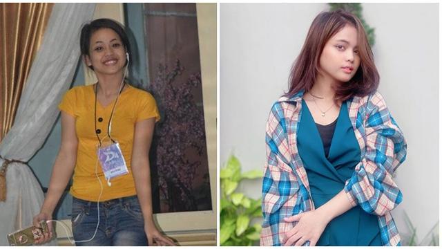 6 Potret Dulu Vs Kini Jebolan D’Academy yang Awali Karier Sebelum Usia 20 Tahun