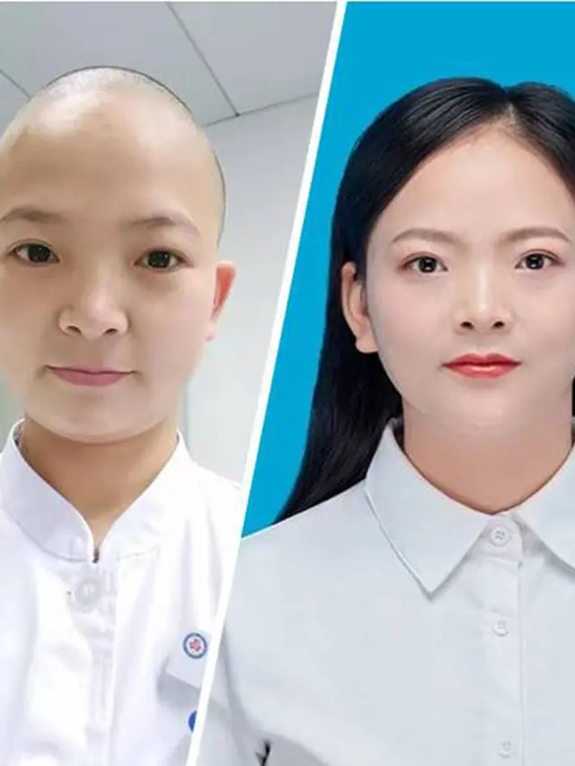 Perangi Virus Corona, Perawat di Wuhan Cukur Rambut Panjangnya Sampai Botak