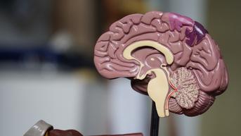 Mengenal Tumor Otak Primer dan Sekunder serta Gejalanya