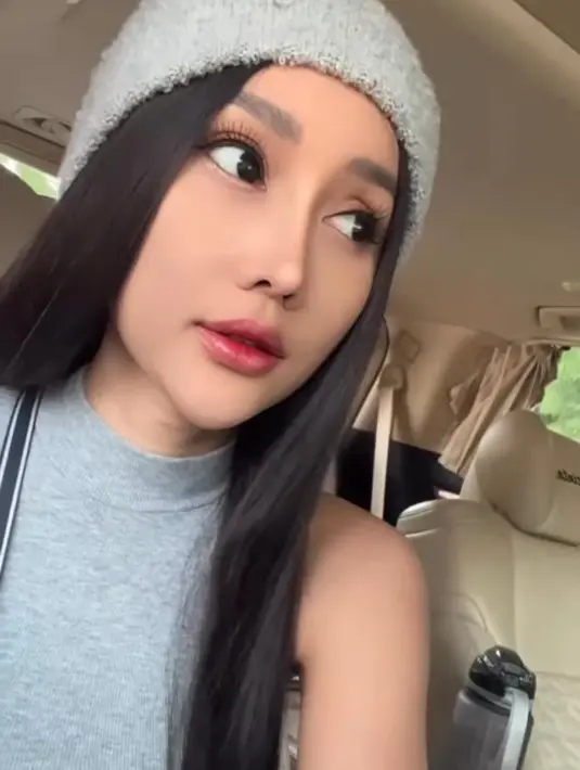 Bahkan, bagian bibirnya juga terlihat lebih tebal dibandingkan sebelumnya. (Instagram/lucintaluna_manjalita)