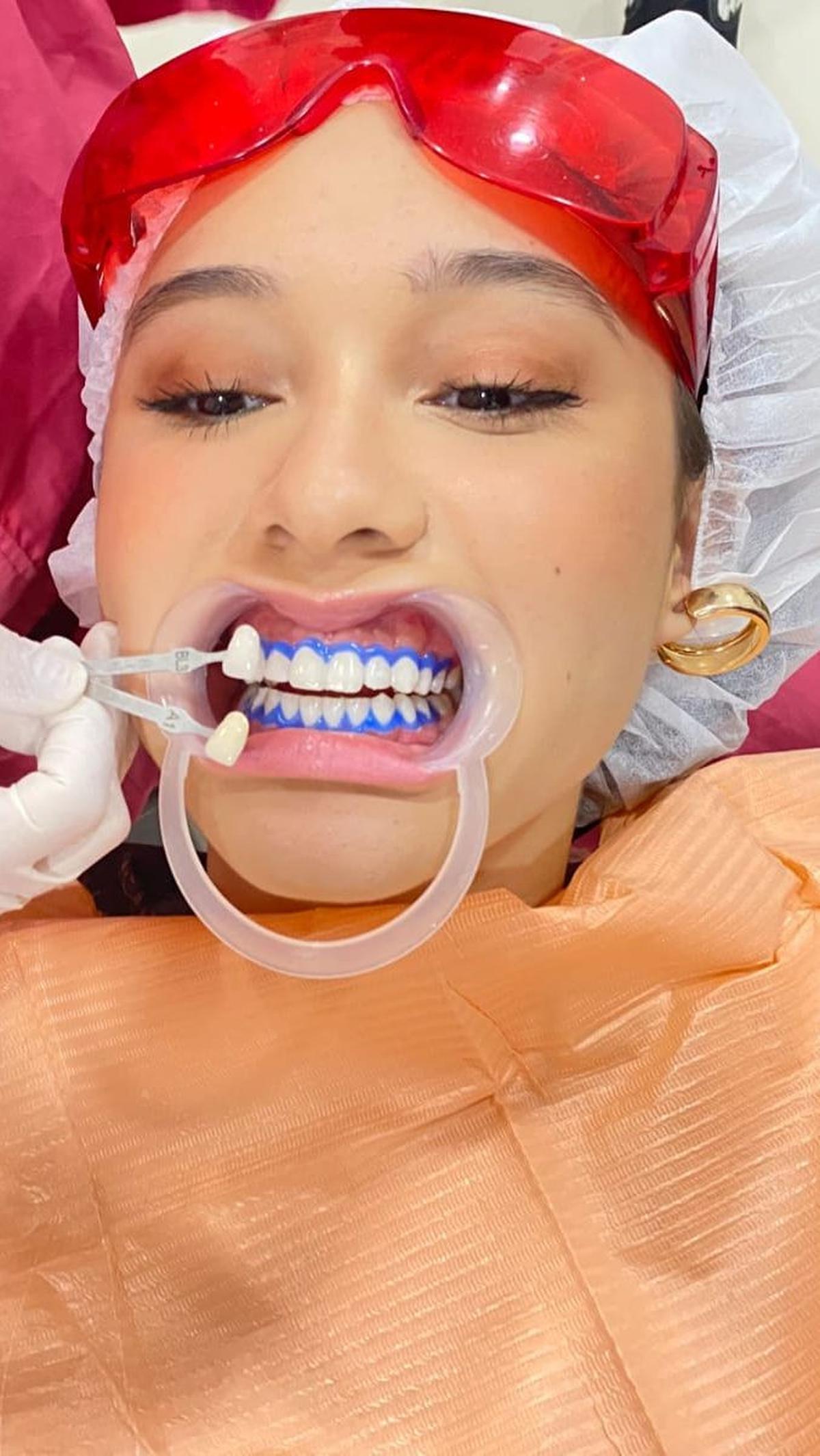 "Mau treatment Mouth Rehabilitation, biar tambah percaya diri aja," ujar Yasmin Napper.