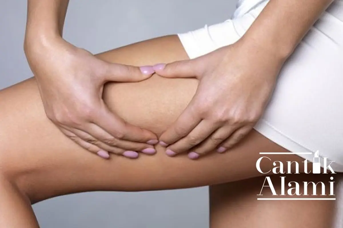 Cantik Alami: Cara Menghilangkan Selulit dengan Bahan Dapur