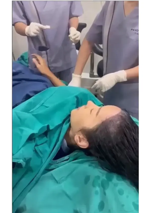6 Potret Lucinta Luna Transplantasi Rambut di Thailand, Sempat Curhat saat Dibotaki