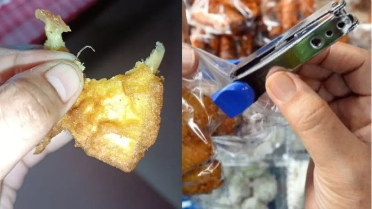 Lidah Bocah Tertusuk Isi Staples