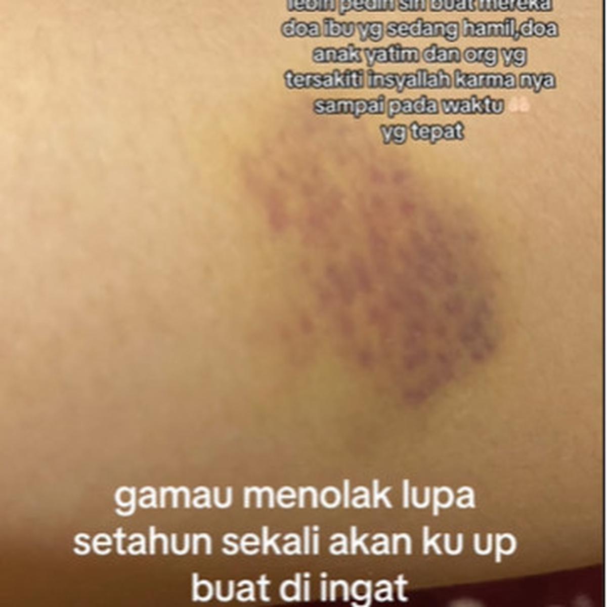 Cerita MUA Tak Dilunasi Riasannya, Ditagih Malah Dipukul sama Ibunya Pengantin 'Saya Lagi Hamil Muda'
