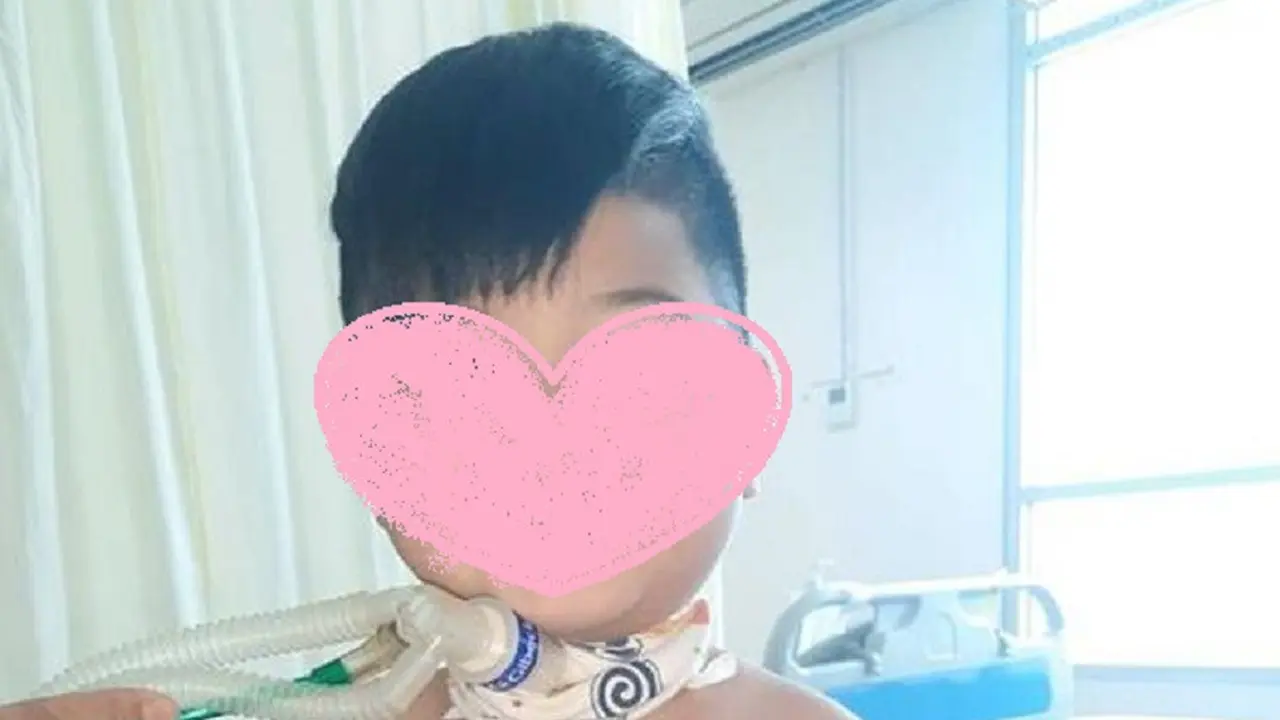 Muhammad Al Fatih alami Jeune Syndrome