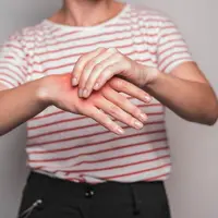 Asam urat tinggi di tangan (Foto: freepik)