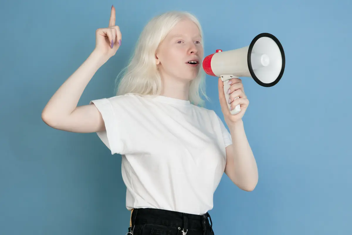 perempuan albino