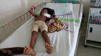 Seorang anak rimba terbaring sakit akibat wabah campak. (Bangun Santoso/Liputan6.com)
